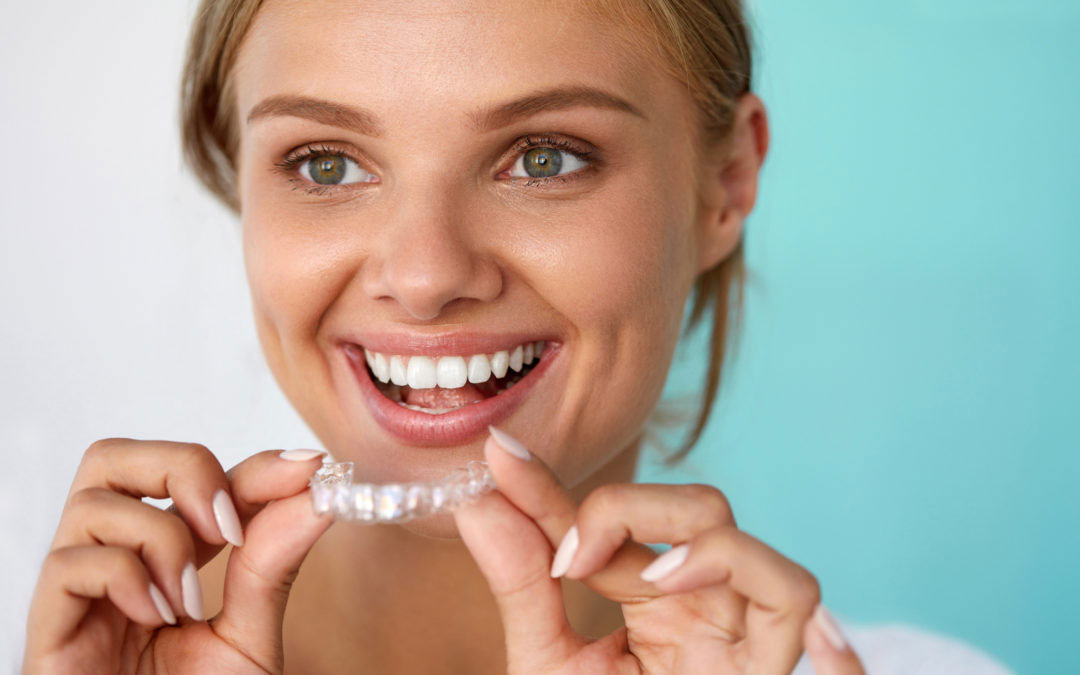 Aparelhos Invisalign