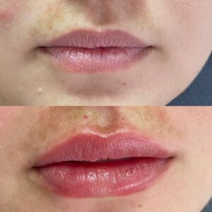 HOF Odontologia Estética