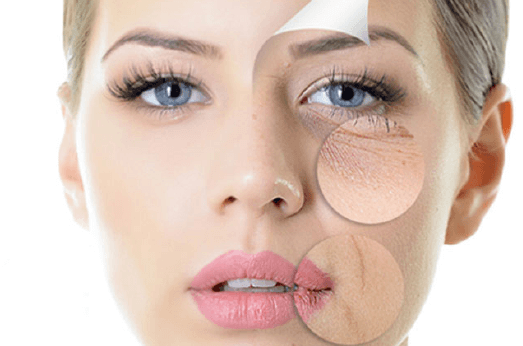 Harmonização Orofacial no HOE: Beleza e Simetria para Seu Rosto