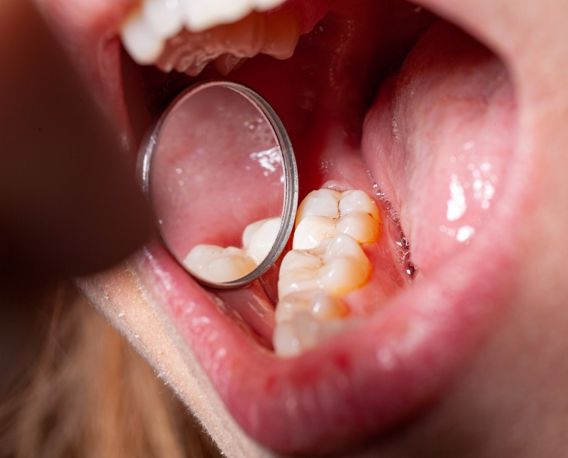 HOE Top oferece os melhores tratamentos odontológicos