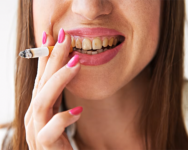 5 Malefícios do Cigarro: Pessoa com dentes manchados devido ao cigarro segurando um cigarro apagado