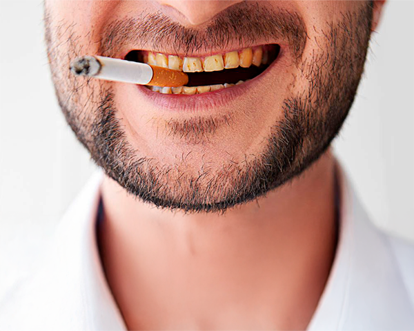 5 Malefícios do Cigarro: Pessoa com dentes manchados devido ao cigarro segurando um cigarro apagado
